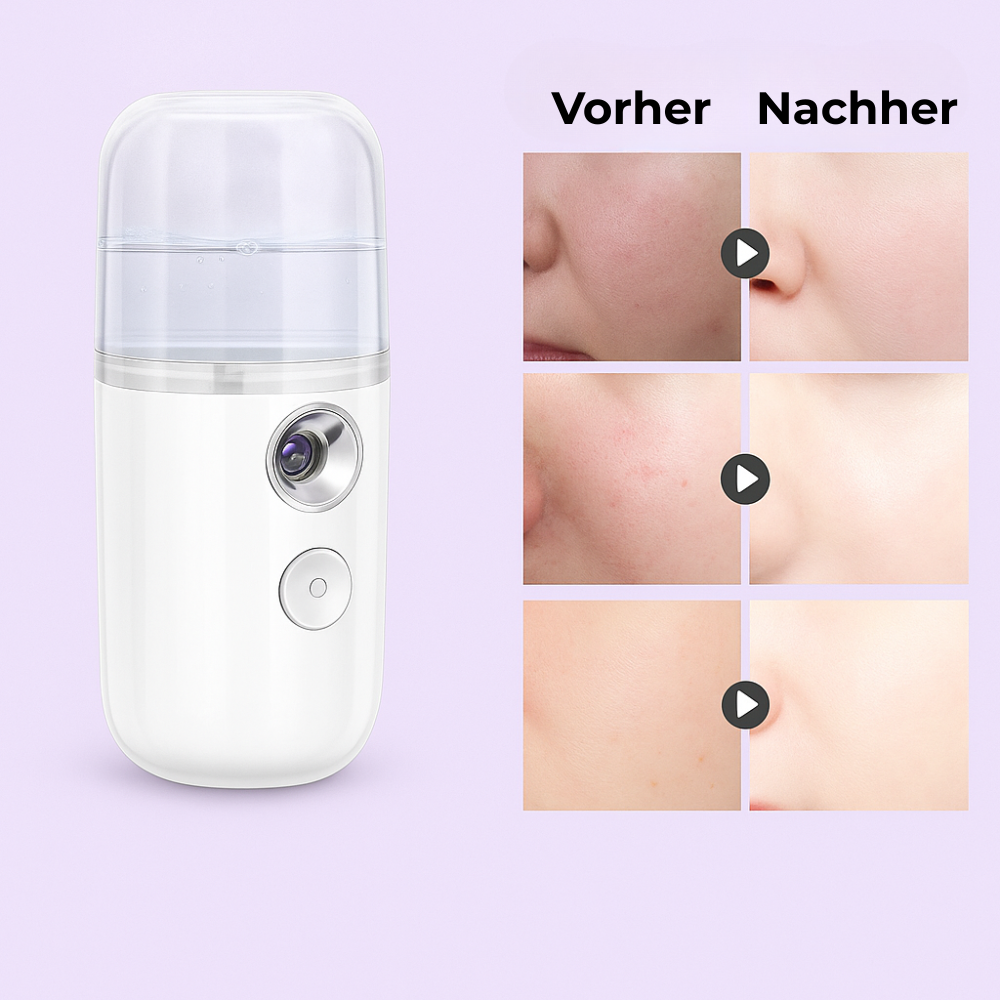 Yobamy - der Ionisierer fürs Gesicht